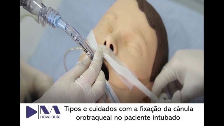 Cânula Orotraqueal: Guia Completo e Atualizado