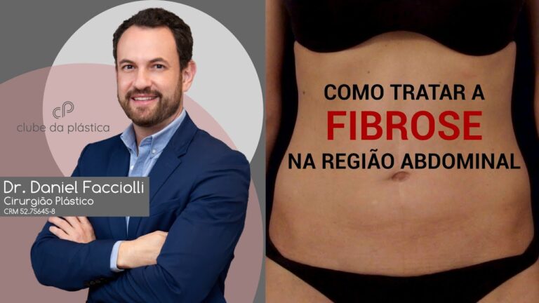 Abd&ocirc;men Fibroso: Causas, Sintomas e Tratamentos