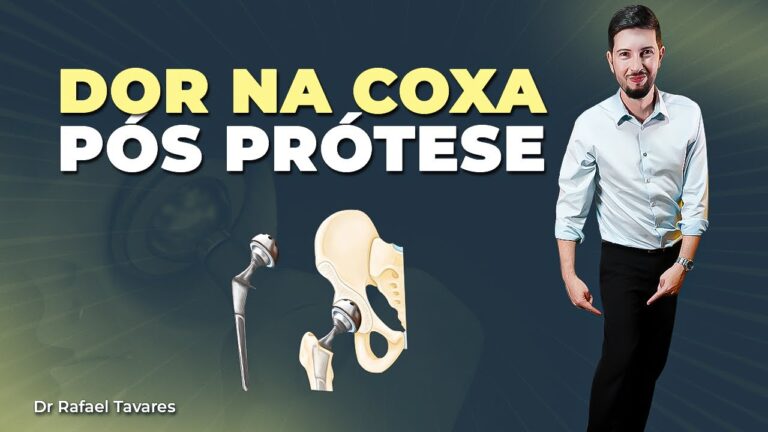 Como aliviar a dor na perna ap&oacute;s artroplastia de quadril
