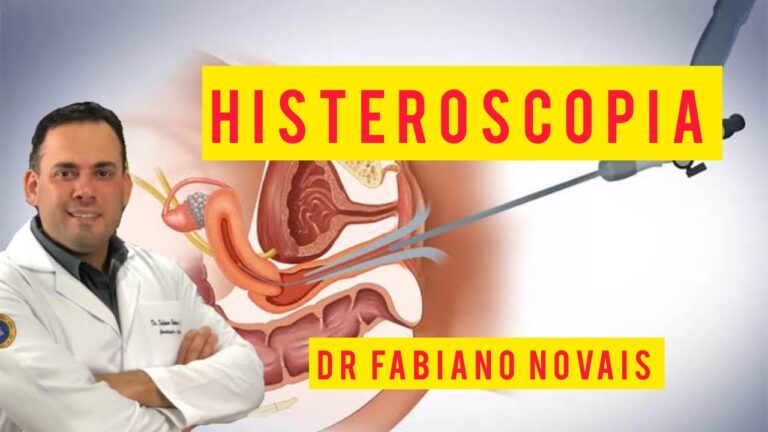 Remoção de Corpo Estranho no Útero: Uma Abordagem Otimizada