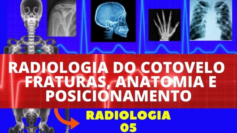 Diagnóstico de Fraturas no Cotovelo: O Papel do Raio X