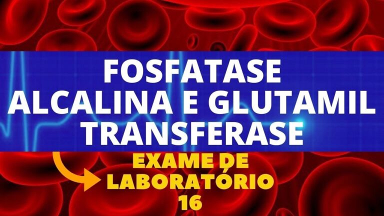 Níveis otimizados de Gama GT e Fosfatase Alcalina: O que você precisa saber
