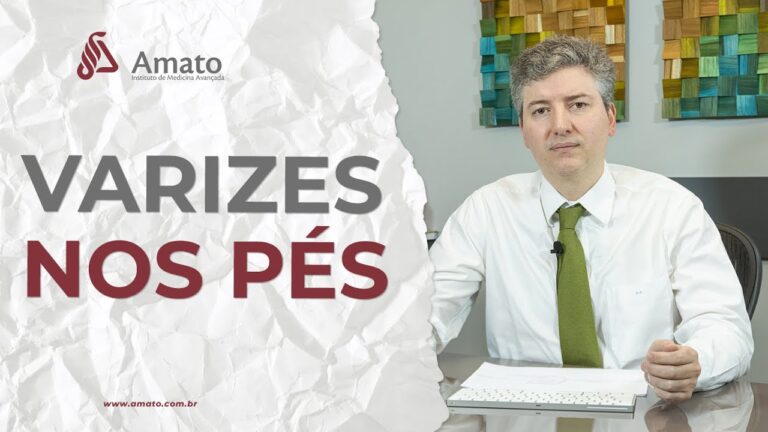 Veias Saltadas nos Pés: Como Tratar?