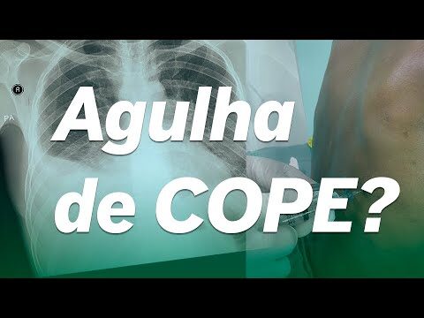 A Importância da Agulha de Cope na Pesca