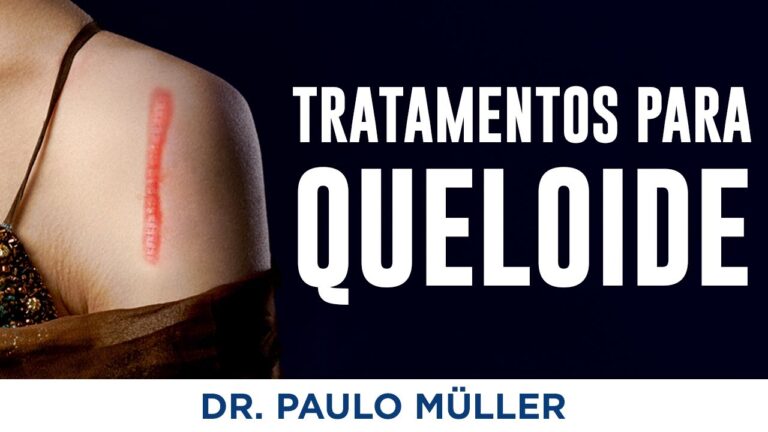 Especialistas em Queloide: Tratamentos Eficazes e Resultados Promissores