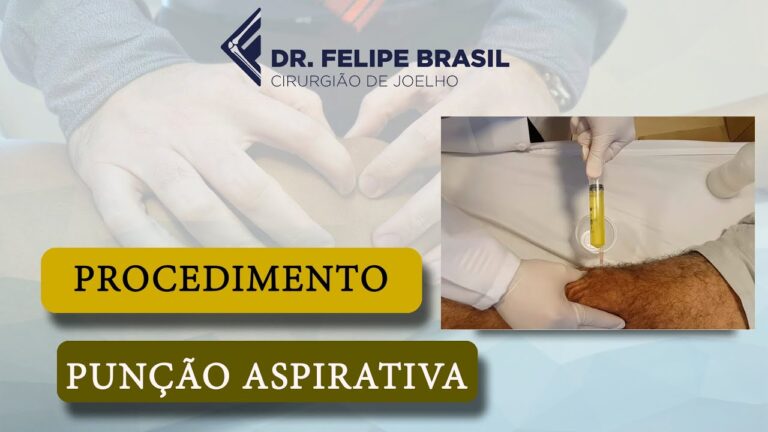 Guia Completo sobre Punção no Joelho
