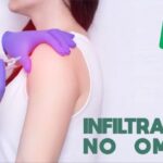 Síndrome de Colisão do Ombro: Causas e Tratamentos