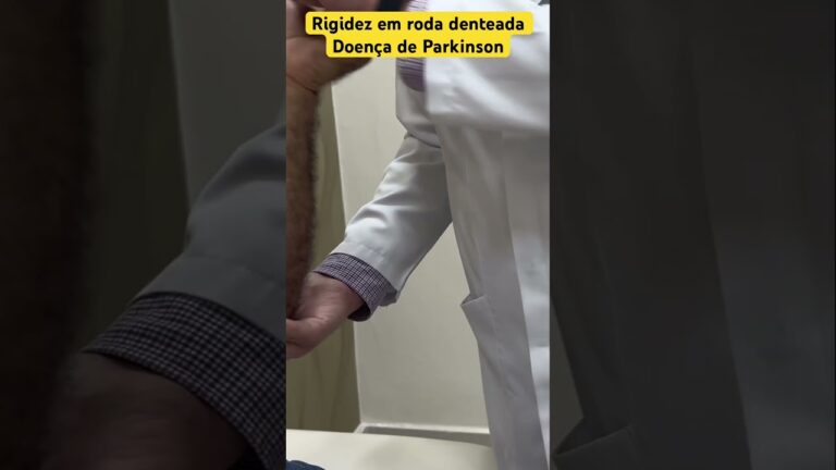 Como Resolver Problemas de Rigidez em Rodas Dentadas