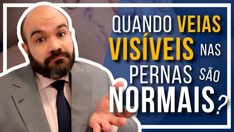 Veias muito aparentes: causas e tratamentos