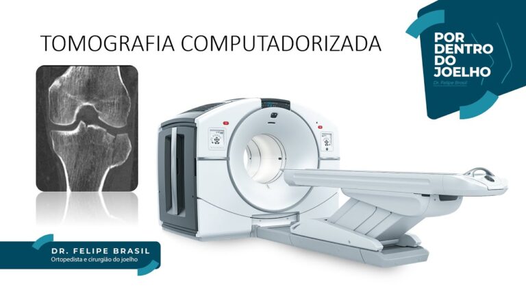 TC de Joelho: Guia Completo e Atualizado