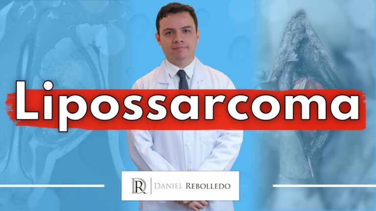 Sintomas de Lipossarcoma: O Que Você Precisa Saber