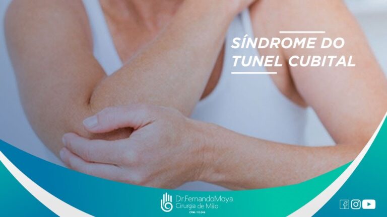 Síndrome do Canal Cubital: Causas, Sintomas e Tratamentos