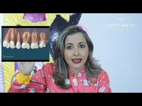 Dente doendo: causas e tratamentos