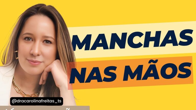 Melasma nas mãos: causas e tratamentos