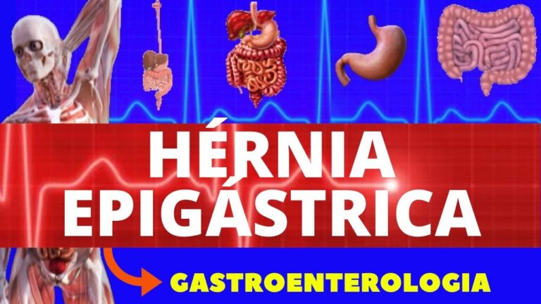 Recuperação da hérnia epigástrica: guia otimizado