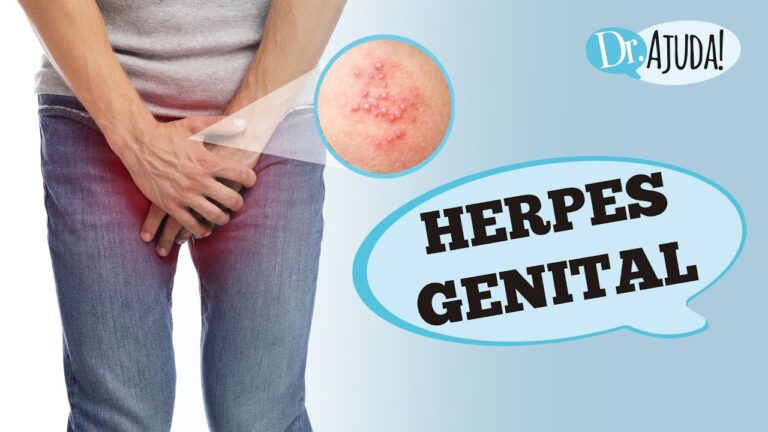 Exame de Herpes: Tudo o Que Você Precisa Saber