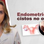 Como identificar varizes: 5 sinais que não pode ignorar