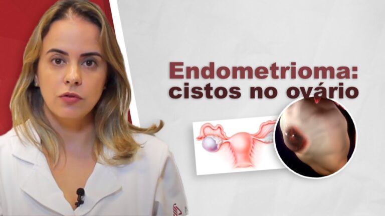 Entendendo o Cisto Endometriótico: Sintomas, Diagnóstico e Tratamento