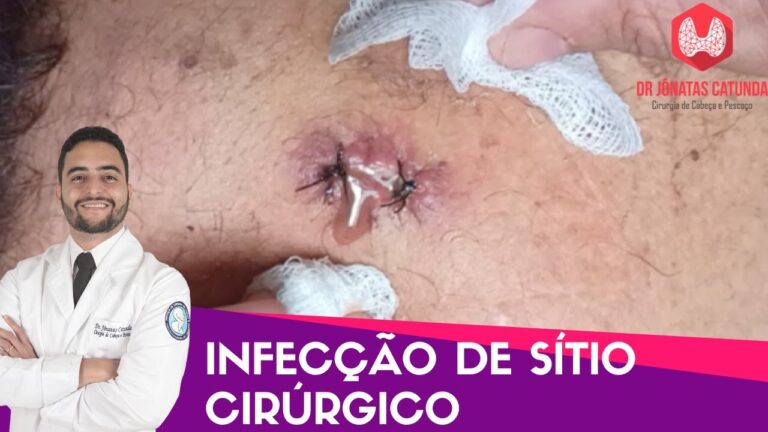 Tratamento Eficaz para Pontos de Cirurgia Inflamados