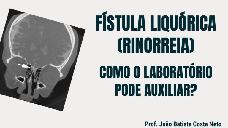 Guia dos Sintomas da Fístula Liquórica Nasal
