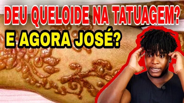 Como prevenir queloide ap&oacute;s tatuagem
