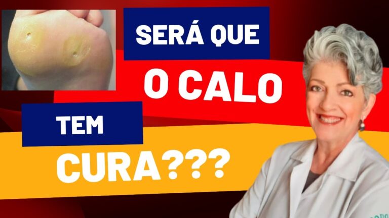 Calo com Núcleo: Mitos, Verdades e Possíveis Tratamentos