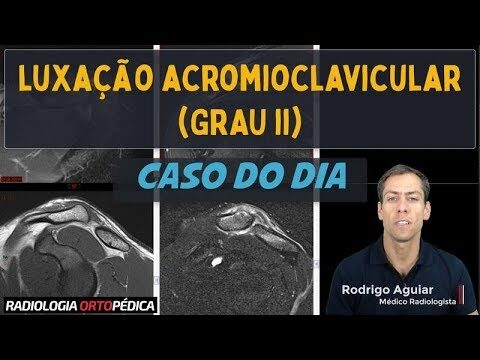 Diagnóstico e tratamento da luxação acromioclavicular grau 1