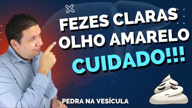 Pedra na Vesícula: Saiba se ela Sai nas Fezes
