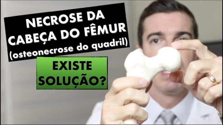 Necrose no Quadril: Causas, Sintomas e Tratamentos