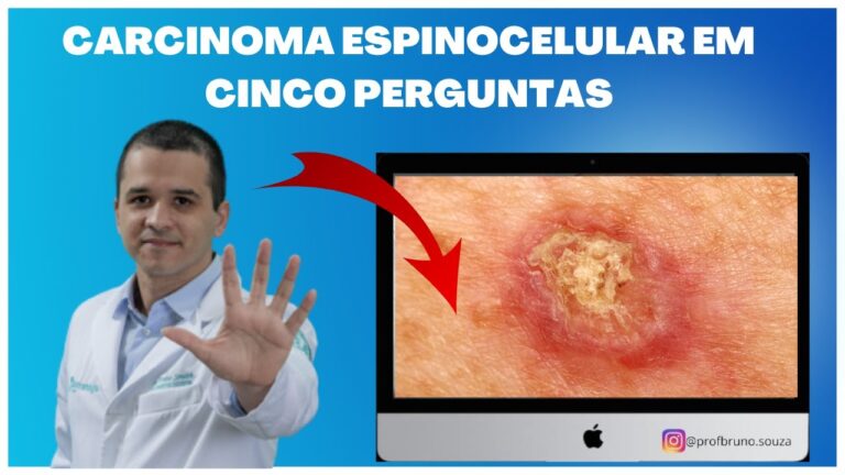 Fotos do Carcinoma Sebáceo: Um Guia Visual Completo