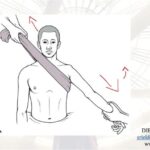 Síndrome de Colisão do Ombro: Causas e Tratamentos