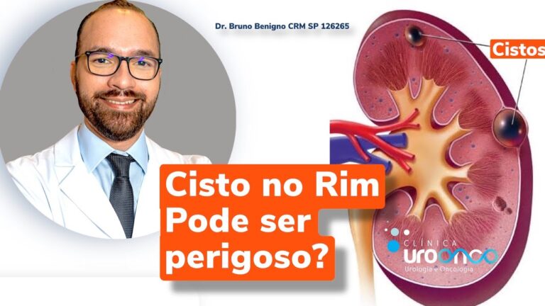Cistos Peri-pélvicos: O Que Você Precisa Saber