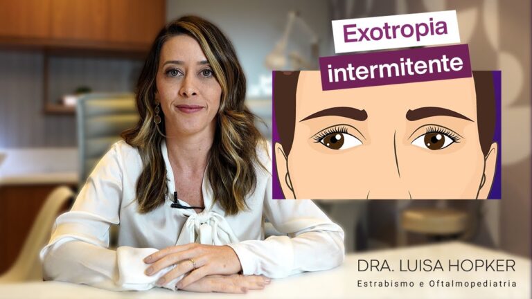 Estrabismo intermitente: causas e tratamentos