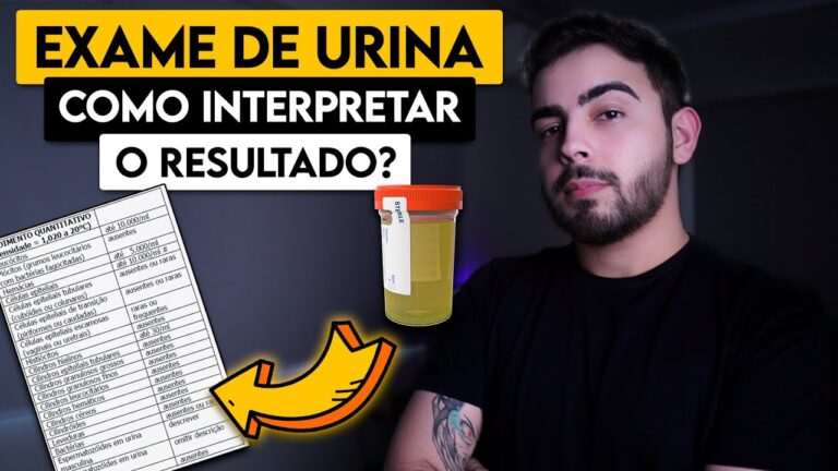 Significado do Sinal de No Exame de Urina: Explicação Concisa