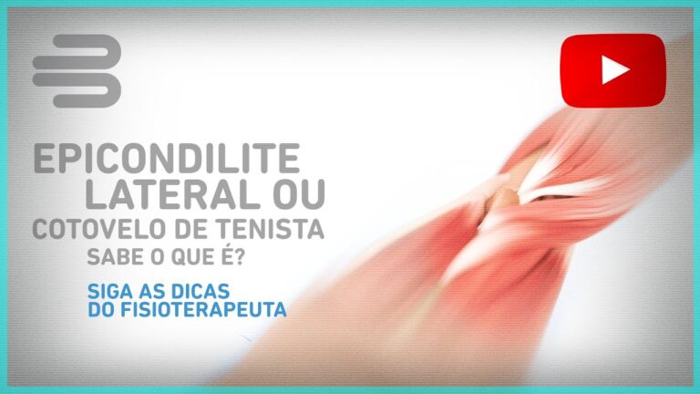 Epicondilite: Causas, Sintomas e Tratamentos