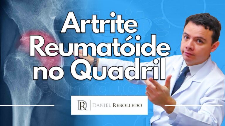 Tratamentos eficazes para artrite no quadril