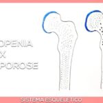 Entenda sobre veia grossa na perna