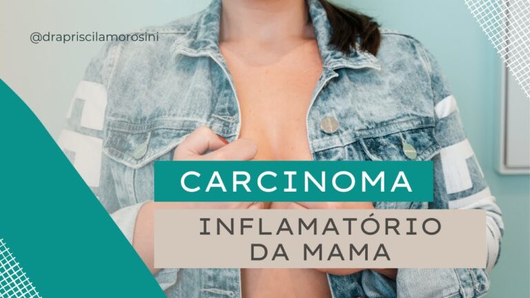 Fotos de Câncer de Mama Inflamatório: Um Guia Visual