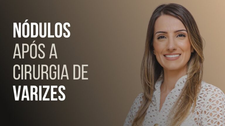 Nódulos pós-cirurgia de varizes: Causas e Tratamentos
