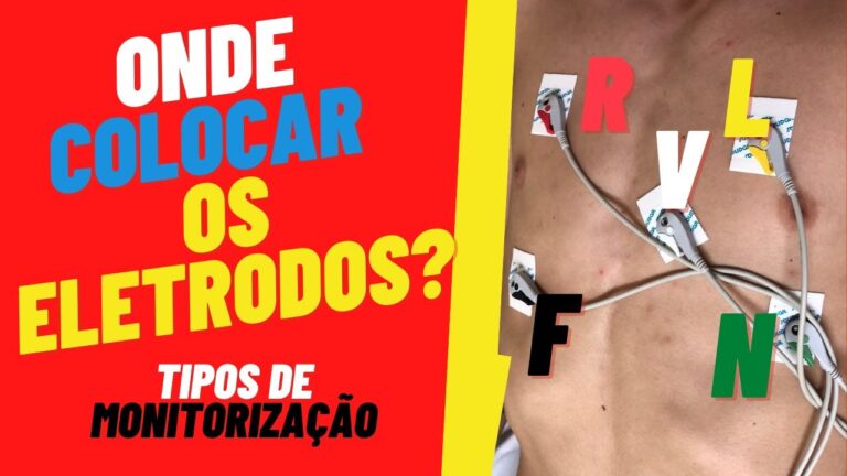 Posicionamento de Eletrodos para Monitoramento Cardíaco