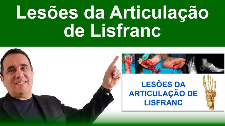 Articulação de Lisfranc: Anatomia, Lesões e Tratamento