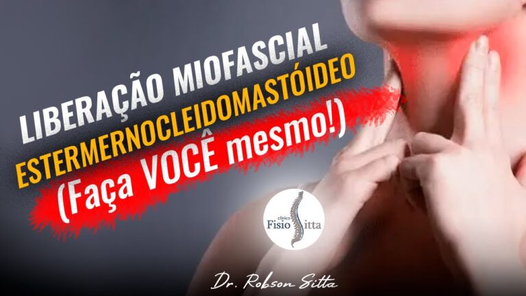 Ponto Gatilho do Esternocleidomastóideo: Causas e Tratamentos