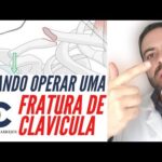 Teste de Visão: Como Saber se Tenho Problemas de Vista