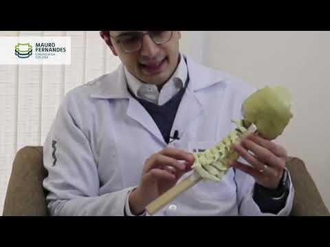Tratamento eficaz para fratura da coluna cervical