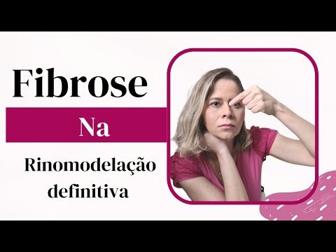 Fotos de fibrose nasal: Um guia visual completo