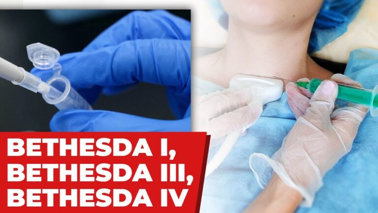 Significado da Ausência de Células Foliculares da Tireoide