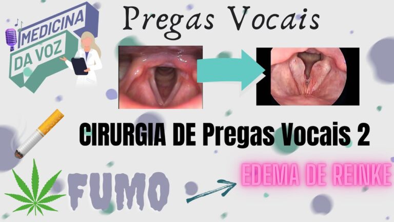 Edema de Reink: Causas e Tratamentos