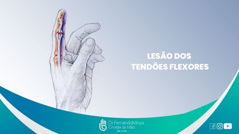Anatomia e Função dos Tendões Flexores da Mão