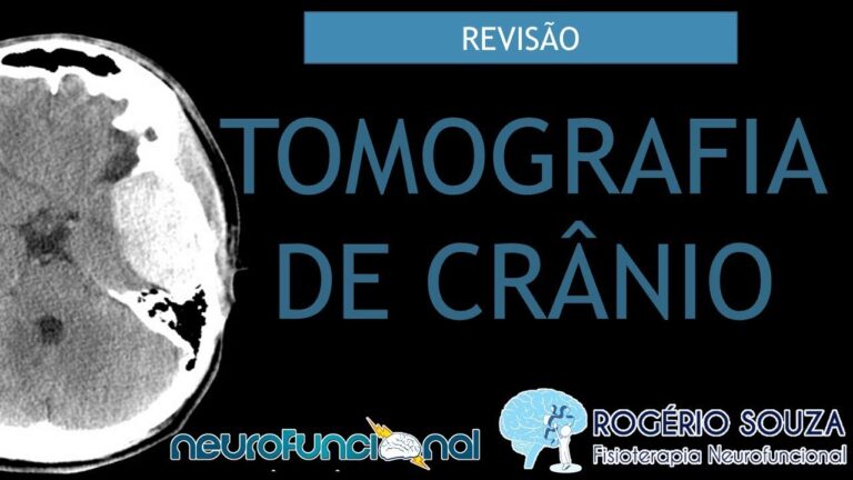 Entendendo a Tomografia da Cabeça: Procedimento e Resultados