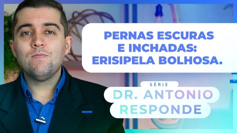 Como Aliviar Pernas Escuras e Inchadas: Guia Pr&aacute;tico